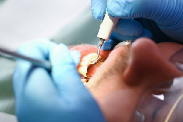 Best Pediatric Emergency Dentist in Earlysville, VA