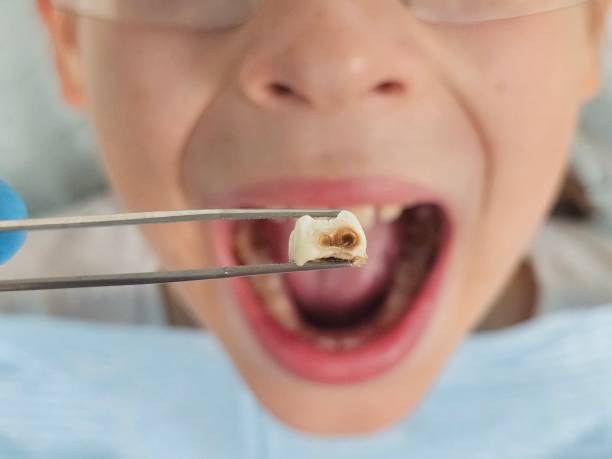 Best After-Hours Emergency Dentist in Earlysville, VA